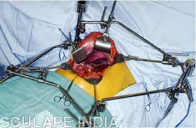 Thompson Retractor System